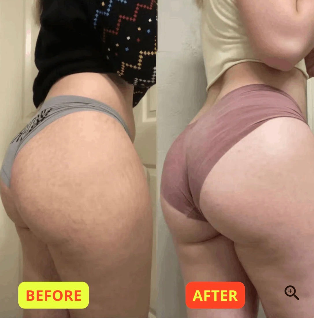 Veloorea™ Sculpt Duo